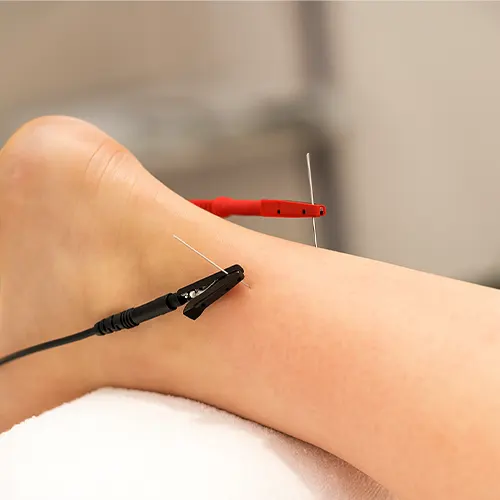 Electroterapia 1 tratamiento electroterapia